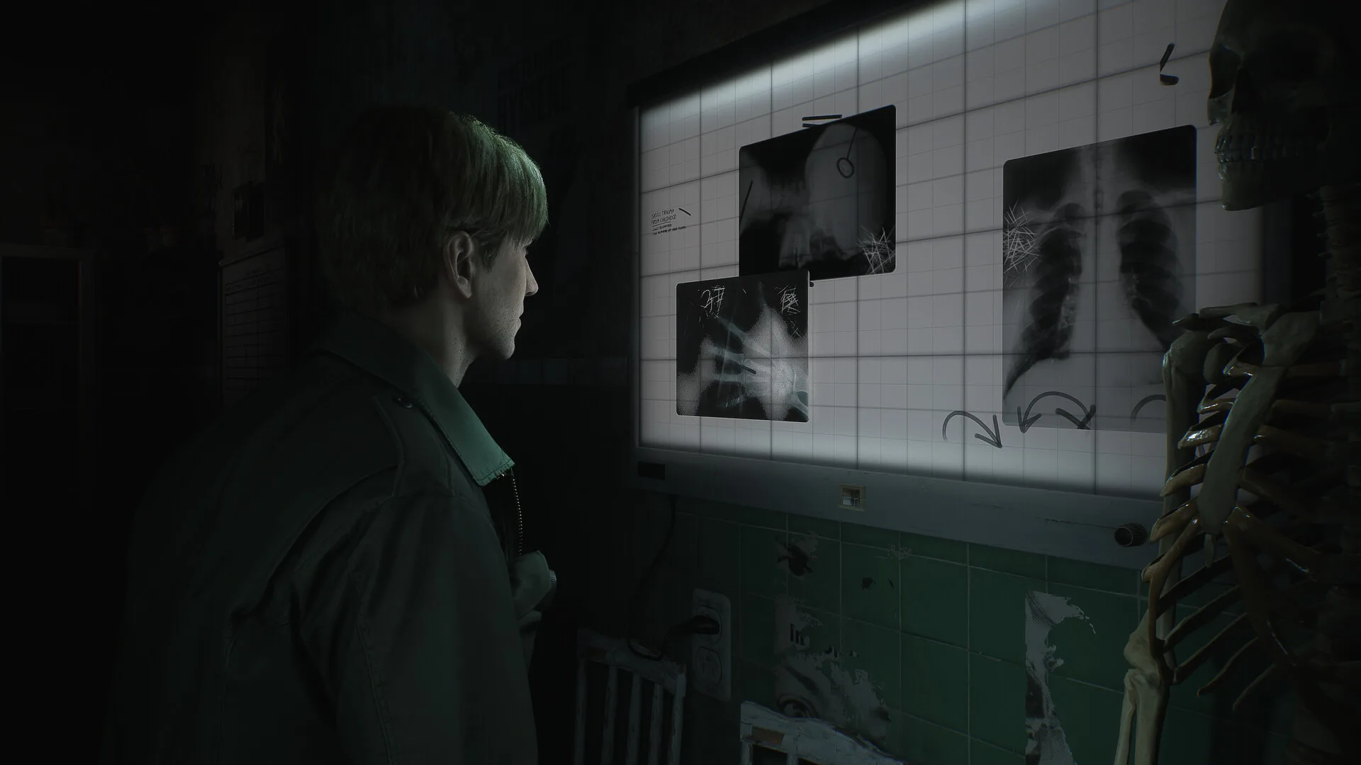 silent hill 2 achievements leaked forensics